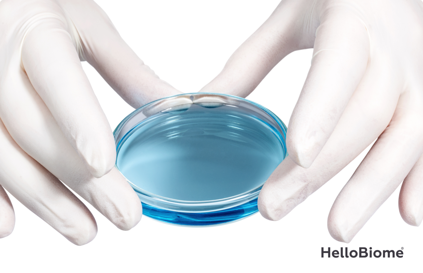 HelloBiome lab sample in a petri dish, prepared for Cutibacterium acnes strain testing as part of skin microbiome claim substantiation.
