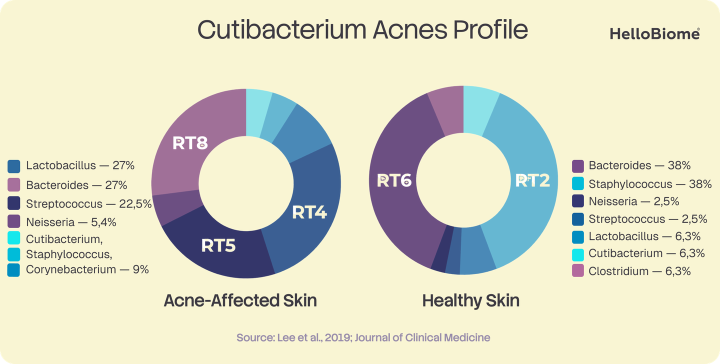 Donut charts comparing Cutibacterium acnes ribotype composition in acne-affected skin (RT8, RT4, RT5 dominant) and healthy skin (RT6, RT2 dominant), sourced from Lee et al., 2019.